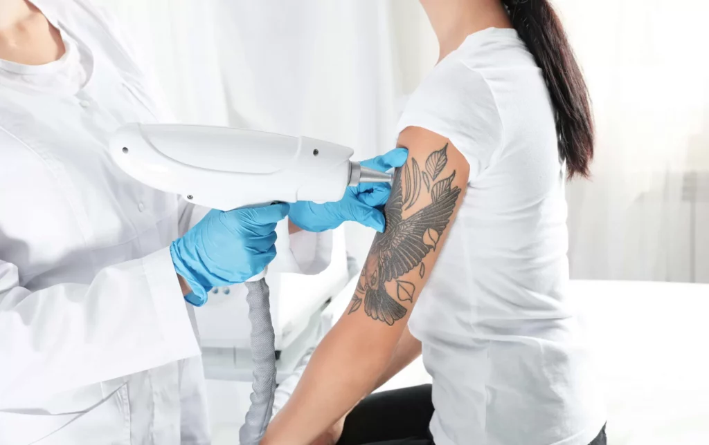 A person with a tattoo and a doctor discussing treatment options